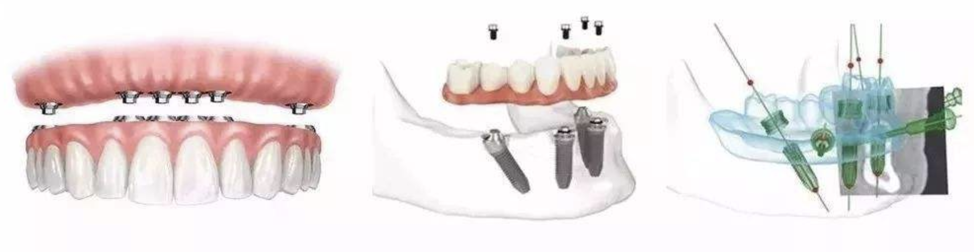 1591079767617346.png 3.png