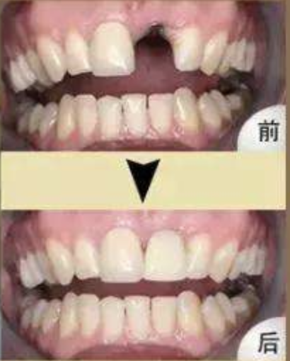 1591079774171884.png 4.png